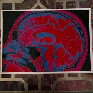 Enhanced Brain X-ray color print by Neurotica